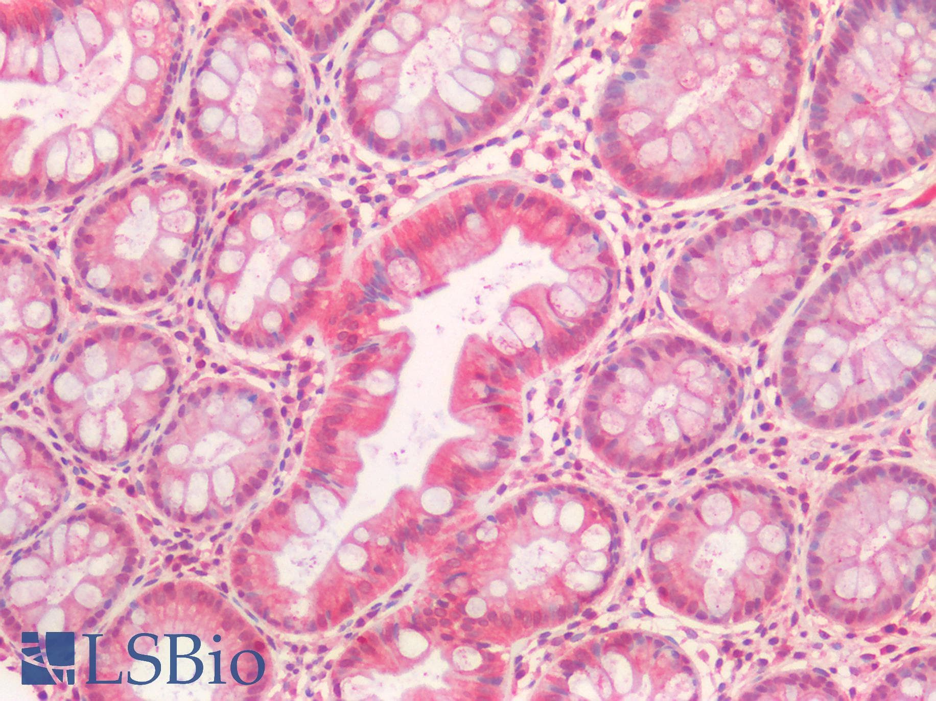 IHC-plus™ HGF / Hepatocyte Growth Factor Antibody
