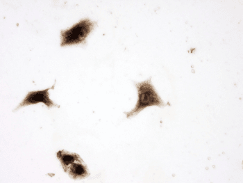 SQSTM1 Antibody