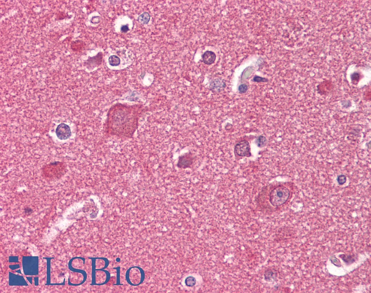 IHC-plus™ Monoclonal Mouse anti-Human RTN1 / Reticulon 1 Antibody (clone RNL-2, IHC, WB)
