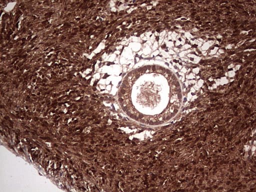 LGALS3 / Galectin 3 Antibody (clone OTI2F1)