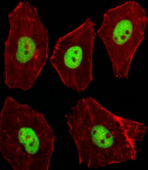 STK11 / LKB1 Antibody (aa393-420)