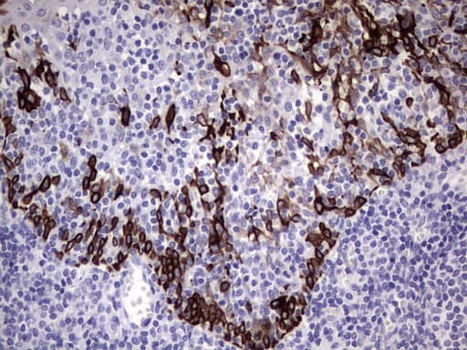 Monoclonal Mouse anti-Human KRT19 / CK19 / Cytokeratin 19 Antibody (clone OTI1F5, aa240-390, IHC, WB)