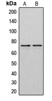 DMPK / DM Antibody (N-Terminus)