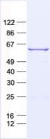 Human MMP1 Protein (Recombinant His, N-Terminal)