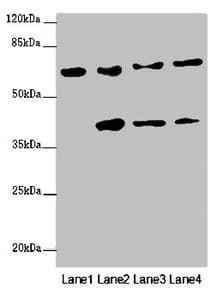 Polyclonal Rabbit anti-Human FBXW5 Antibody (IHC, IF, WB)
