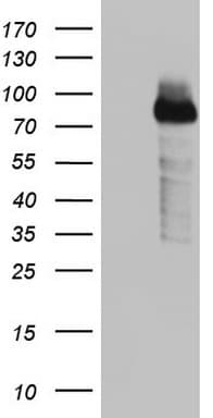 BCL6 Antibody (aa1-300, clone OTI6C7)
