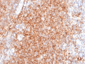 CD40 Antibody (clone C40/2383)