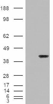 IHC-plus™ Polyclonal Goat anti-Human ARA9 / AIP Antibody (aa310-323, IHC, WB)