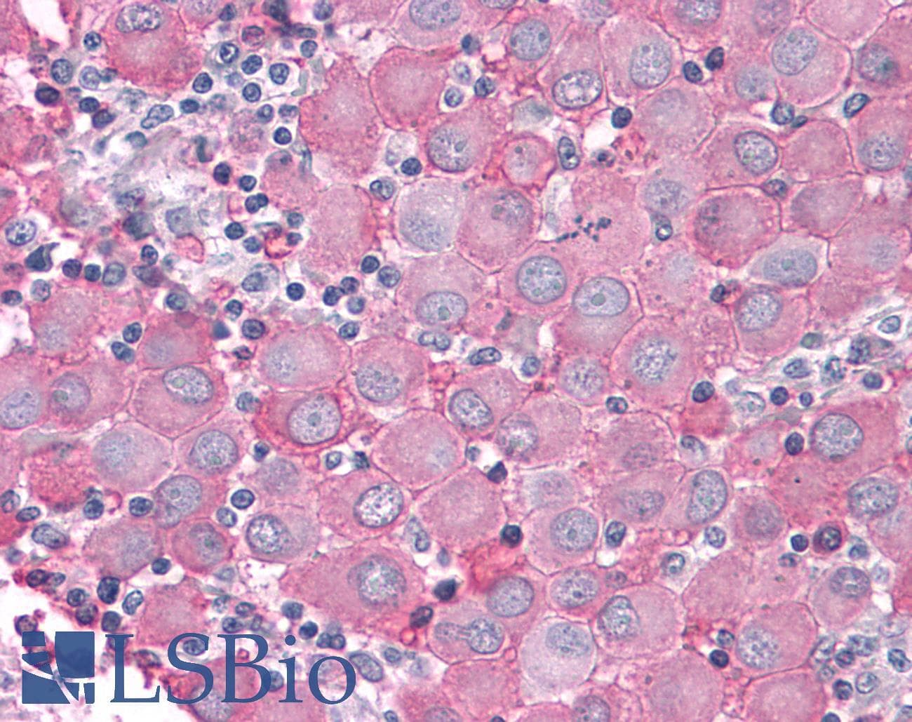 PathPlus™ PTPRA / RPTP-Alpha Antibody (Extracellular Domain)