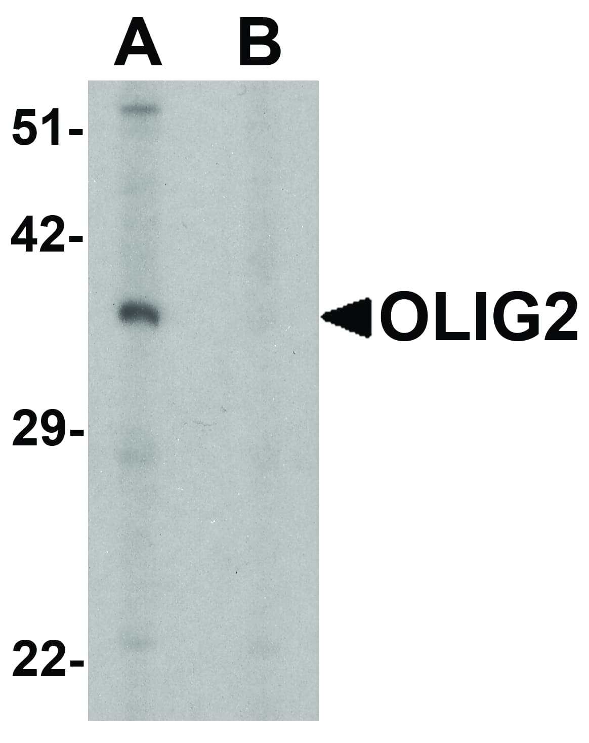 OLIG2 Antibody