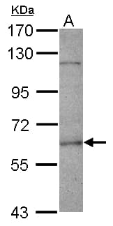 Polyclonal Rabbit anti-Human FANCE Antibody (IHC, WB)