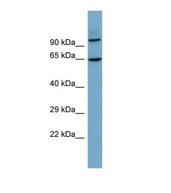 GALNTL6 Antibody (aa95-144)