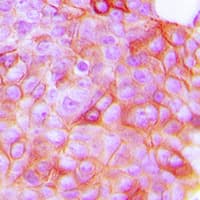 KDR / VEGFR2 / FLK1 Antibody (phospho-Tyr951)