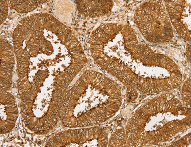 PDP1 Antibody