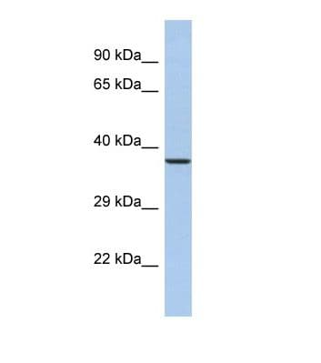 SYT9 / Synaptotagmin 9 Antibody (aa66-115)