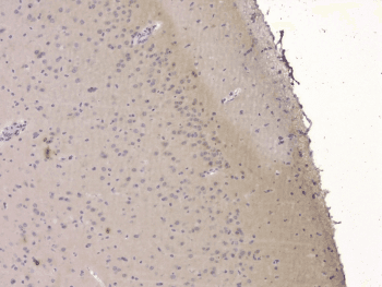 SRCIN1 / SNIP Antibody