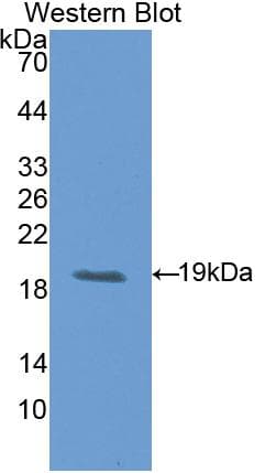 CD118 / LIF Receptor Alpha Antibody (aa642-791)
