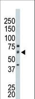 PAK4 Antibody (aa156-187)