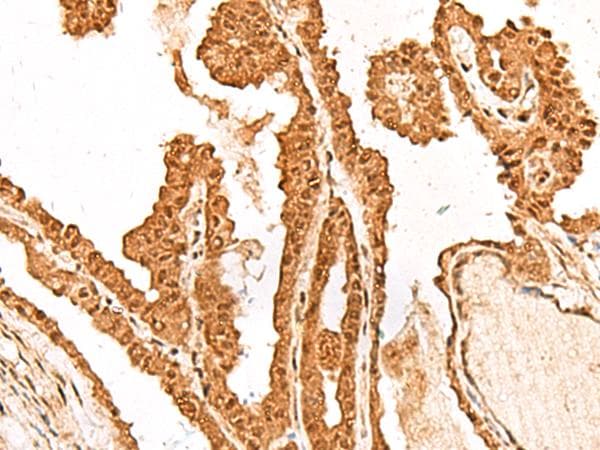 Polyclonal Rabbit anti-Human FAM111B Antibody (IHC)