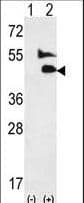 Polyclonal Rabbit anti-Human GDF2 / BMP9 Antibody (aa8-37, IHC, WB)