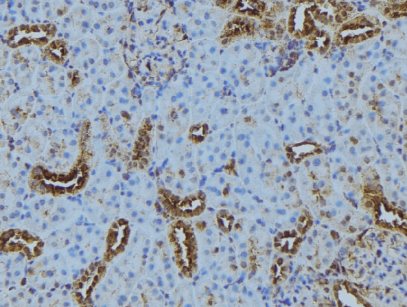 Polyclonal Rabbit anti-Human LAMTOR2 Antibody (IHC, WB)