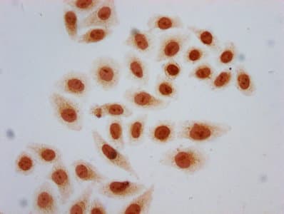 HIST1H2AI Antibody