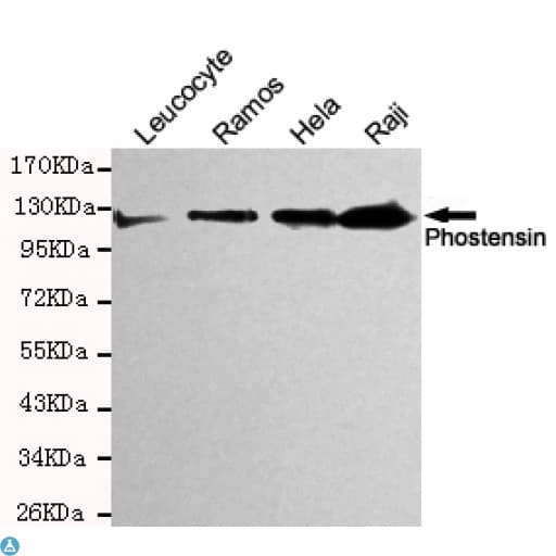 Monoclonal Mouse anti-Human PPP1R18 Antibody (WB)