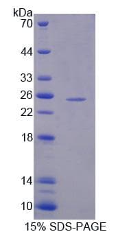 Mouse HMGCS2 / HMG-CoA Synthase 2 Protein (Recombinant His, N-Terminal)