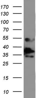 Monoclonal Mouse anti-Human EPCAM Antibody (clone UMAB131, IHC, WB)