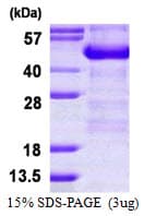 Human ADRM1 Protein (Recombinant His)