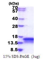 Human CHCHD7 Protein (Recombinant His)