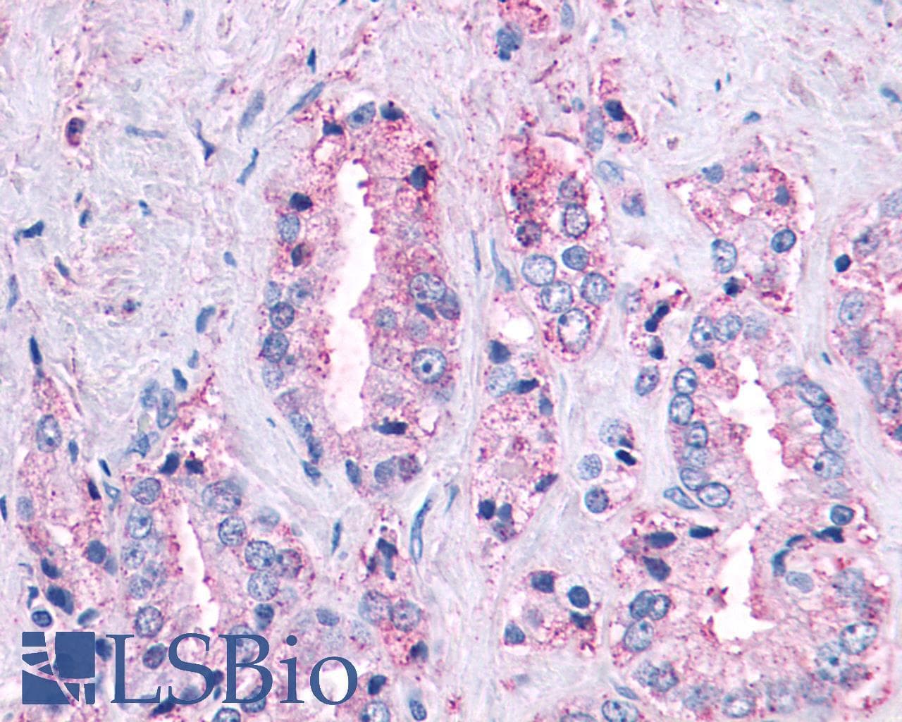 PathPlus™ MAS1 / MAS Antibody (Cytoplasmic Domain)