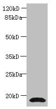 IHC-plus™ CST3 / Cystatin C Antibody