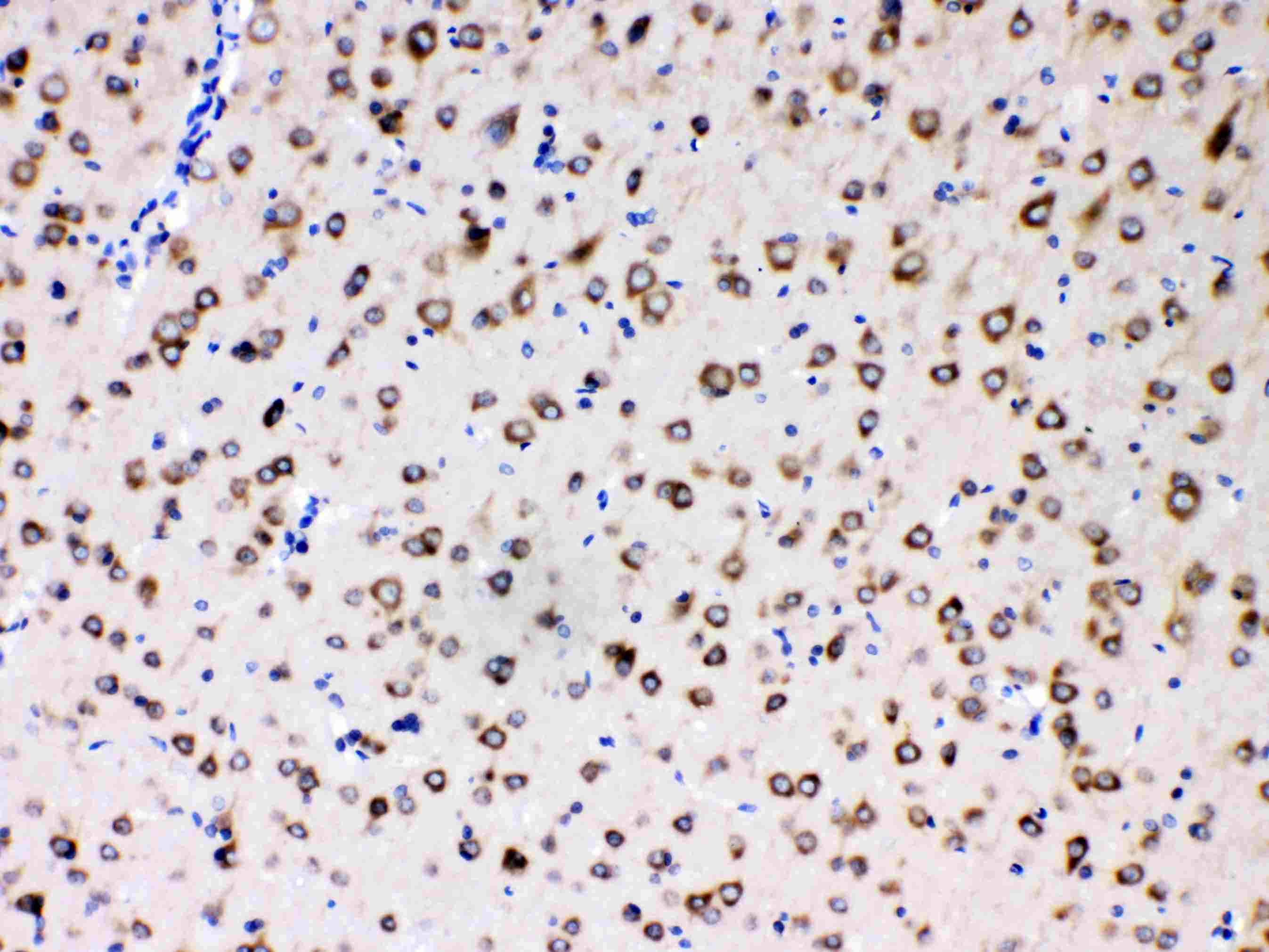 Polyclonal Rabbit anti-Human RPS27 / Ribosomal Protein S27 Antibody (IHC, WB)