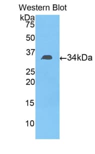 Fibulin-3 / EFEMP1 Antibody (aa166-445)