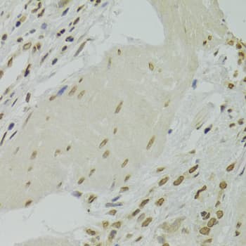 Polyclonal Rabbit anti-Human XRCC6 / Ku70 Antibody (IHC, IF, WB)