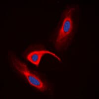 Polyclonal Rabbit anti-Human CBR / CBR1 Antibody (Internal, IHC, IF, WB)