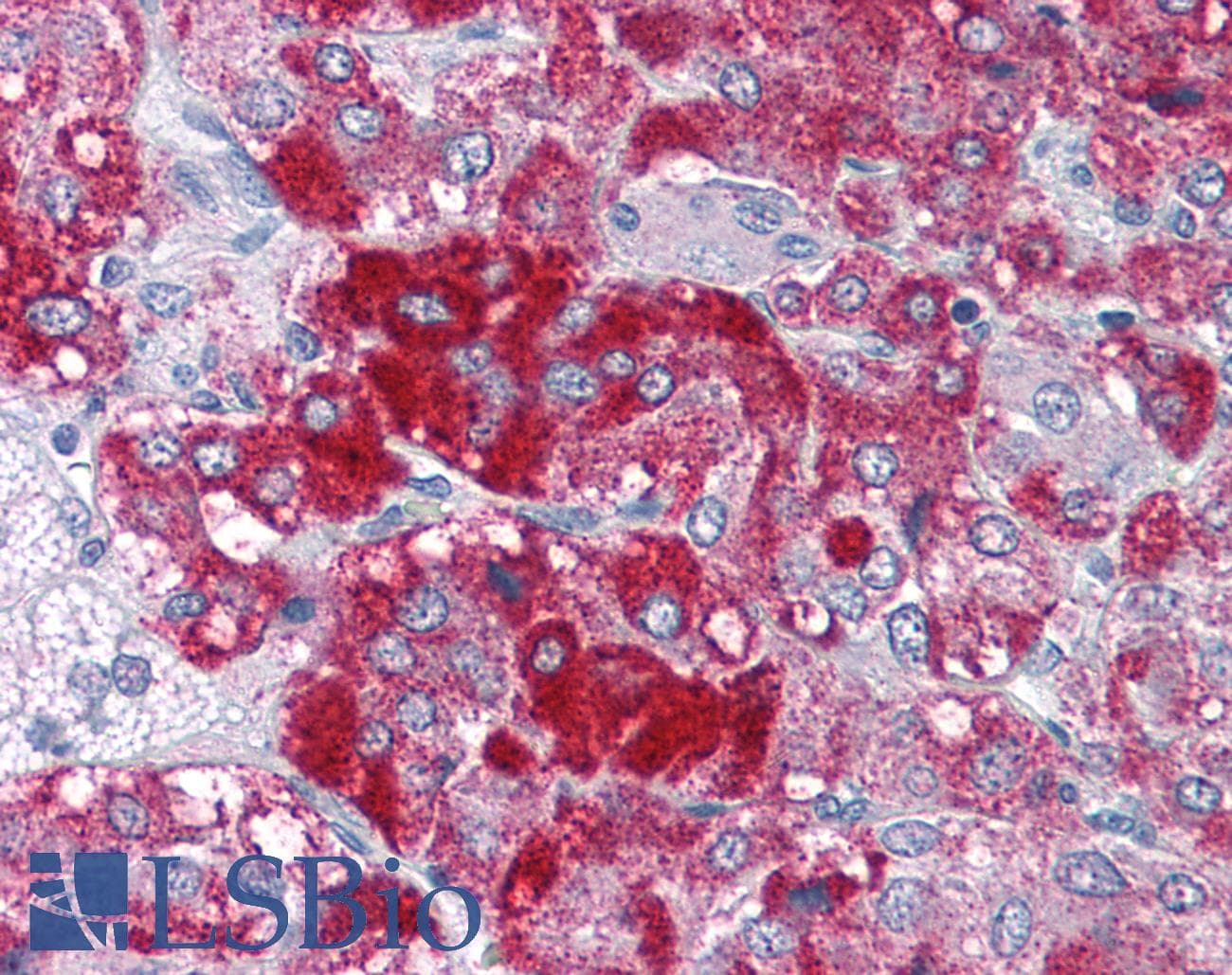 IHC-plus™ Polyclonal Goat anti-Human MYST3 / MOZ Antibody (aa1361-1372, IHC)