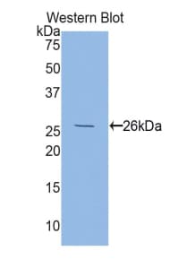FOLR1 / Folate Receptor Alpha Antibody (aa26-229)
