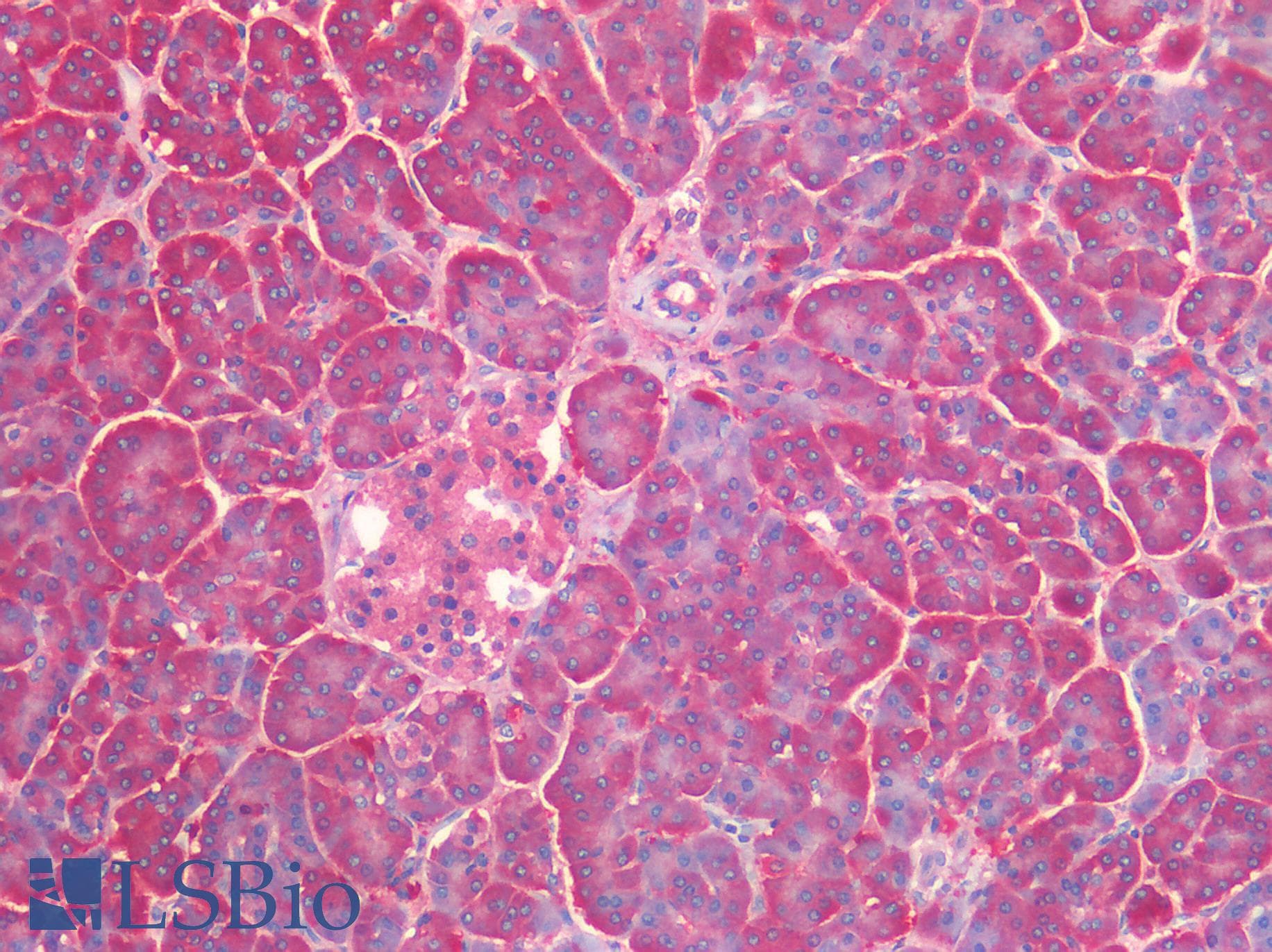IHC-plus™ Polyclonal Rabbit anti-Human GARS / Glycyl tRNA Synthetase Antibody (IHC, IF, WB)
