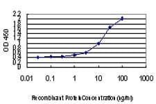 IHC-plus™ DLX2 Antibody (clone 2B12)