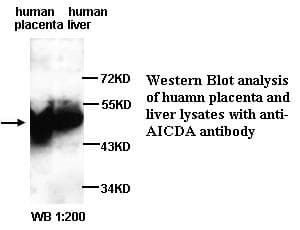 AICDA / AID Antibody (N-Terminus)