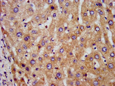 Polyclonal Rabbit anti-Human DLST / E2 Antibody (IHC, IF, WB)