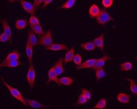 Pan Cytokeratin Antibody (clone C-11)