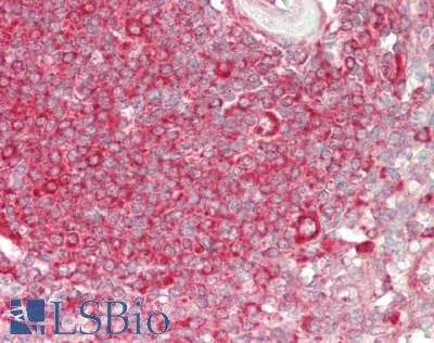 IHC-plus™ RPS3 / Ribosomal Protein S3 Antibody (aa193-243)