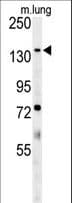 ATP11C Antibody (aa589-616)