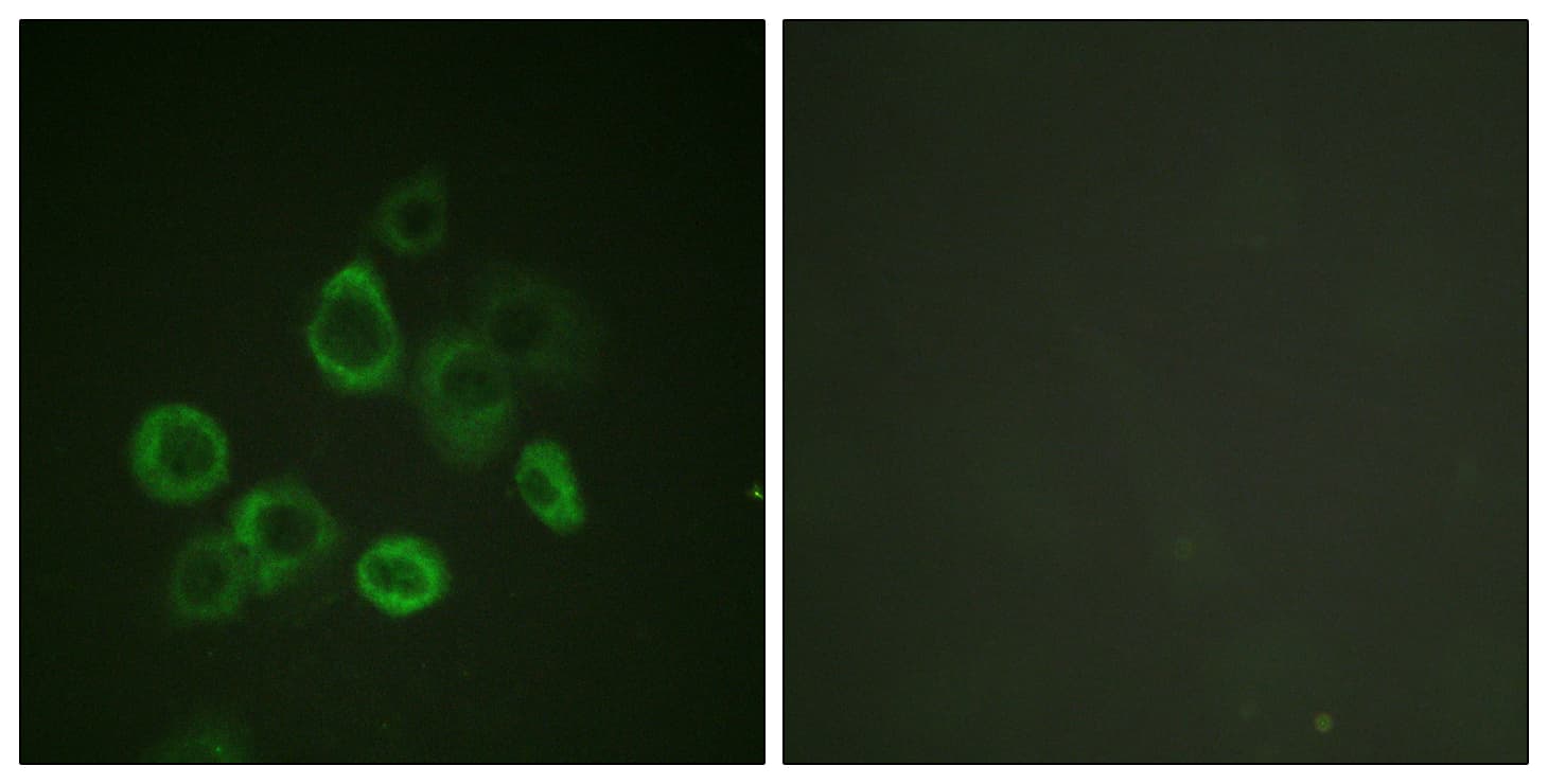 Polyclonal Rabbit anti-Human BAX Antibody (aa133-182, IF, WB)