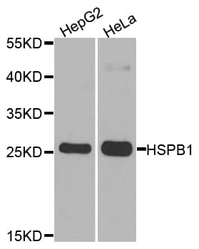 Polyclonal Rabbit anti-Human HSPB1 / HSP27 Antibody (IHC, IF, WB)