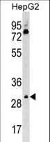 CDK6 Antibody (aa285-312)