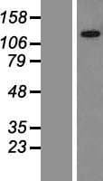 GLTSCR1L / KIAA0240 Protein (Over-Expression Lysate Myc-DDK (Flag))